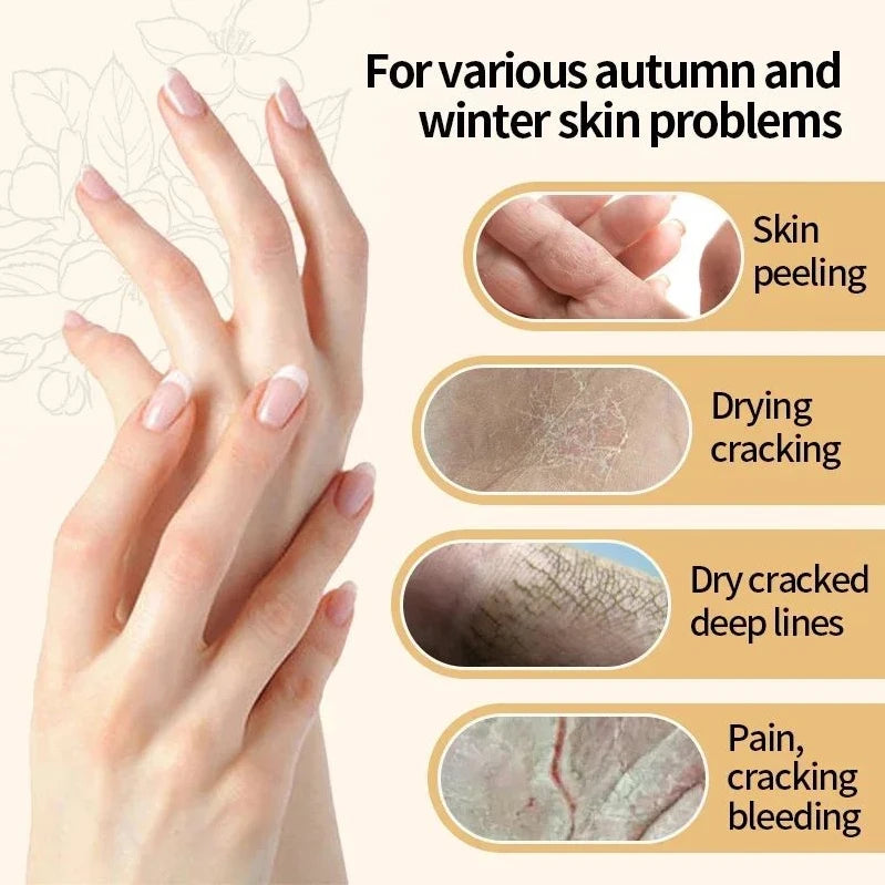 Banana squalane Anti-wrinkle Hand Cream Skin Soften Nourish Whitening Moisturizing Korean SkinCare Cracked Repair Product