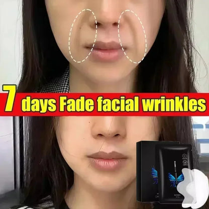 Hyaluronic Acid Anti-Wrinkle Nasolabial Mask Deep Hydration Nourishing Repair Firming Lifting Fade Fine Lines Korean Skincare