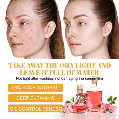 Restore Skin Radiance! Hoygi Turmeric Facial Cleanser Deep Cleansing Moisturizing Whitening and Skin-Purifying Fading Acne Marks