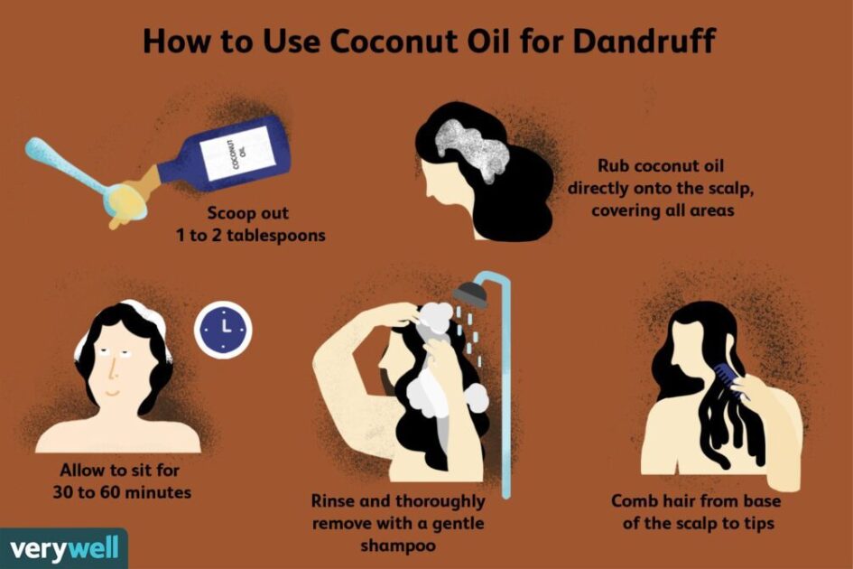 How To Use Coconut Oil For Dry Scalp And Dandruff